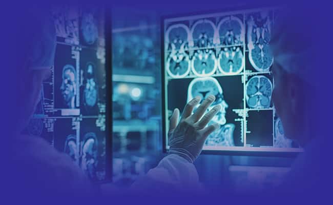מחקר זיהוי באמצעות MRI
