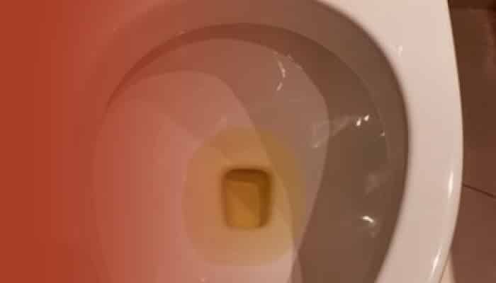 Bildklassifizierung für intelligente Badezimmer-Gesundheitsüberwachung