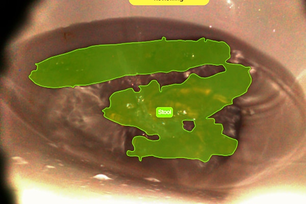 Medical image annotation